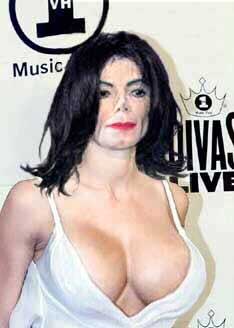 Michael Jackson's Surgery Gone Wrong